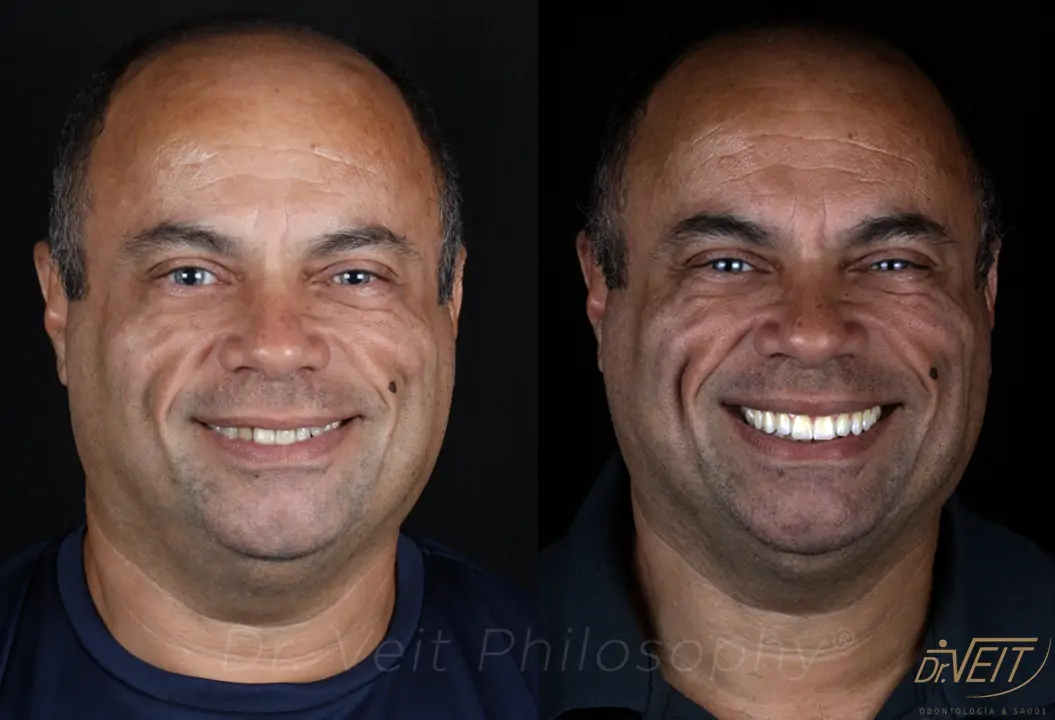 Antes e depois: caso real