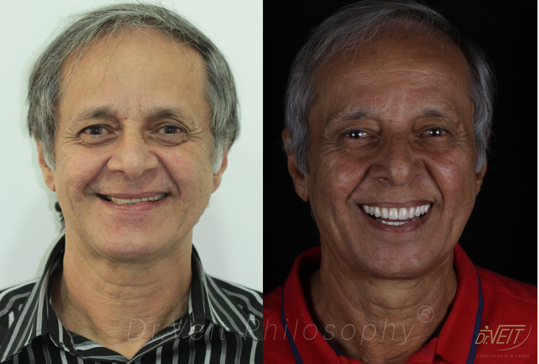 Antes e depois: caso real