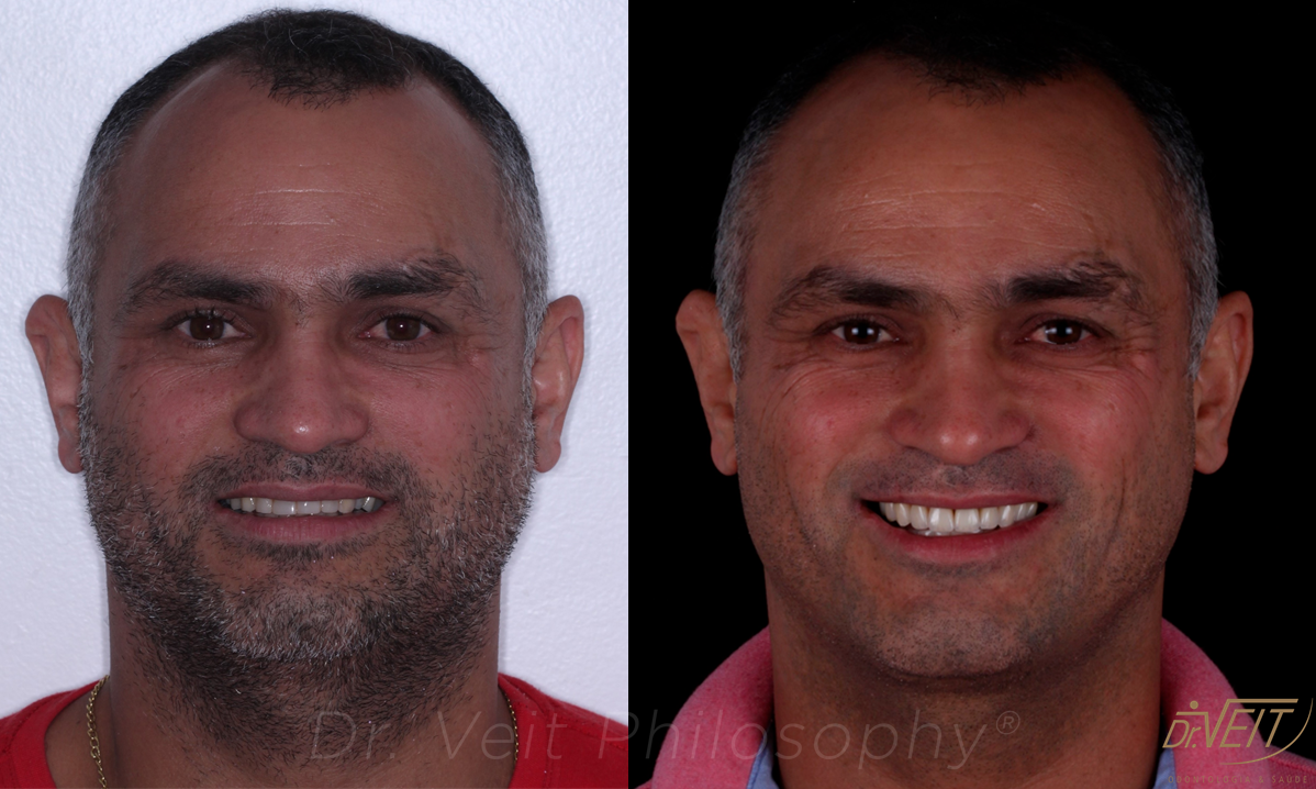 Antes e depois: caso real