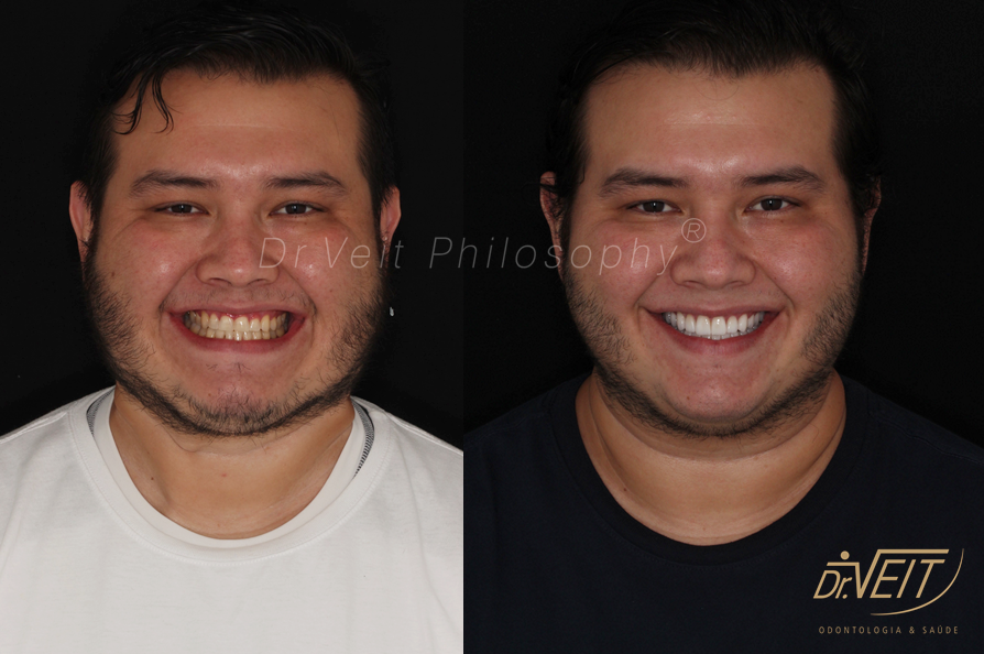 Antes e depois: caso real