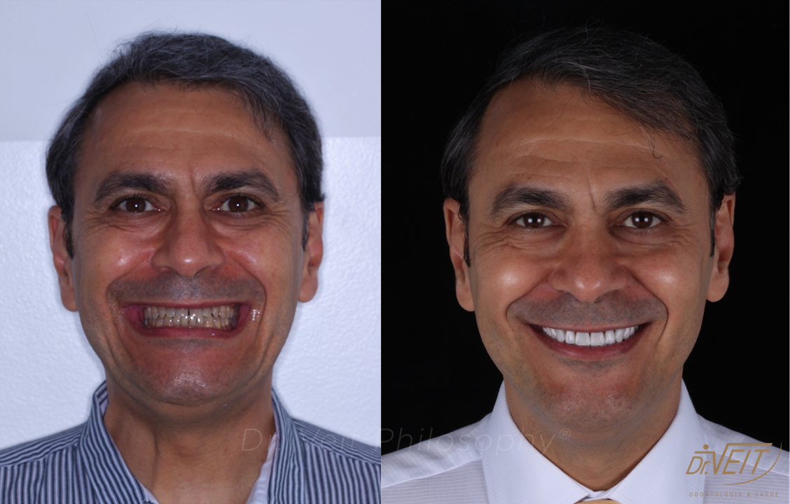 Antes e depois: caso real