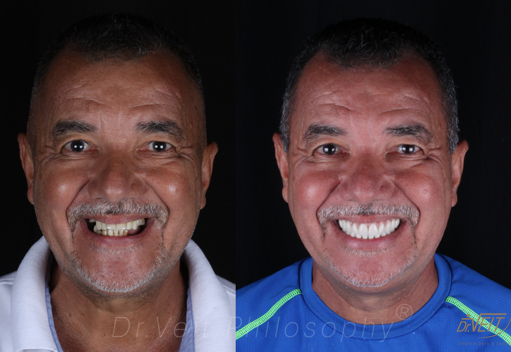 Antes e depois: caso real