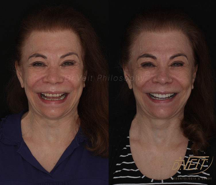 Antes e depois: caso real