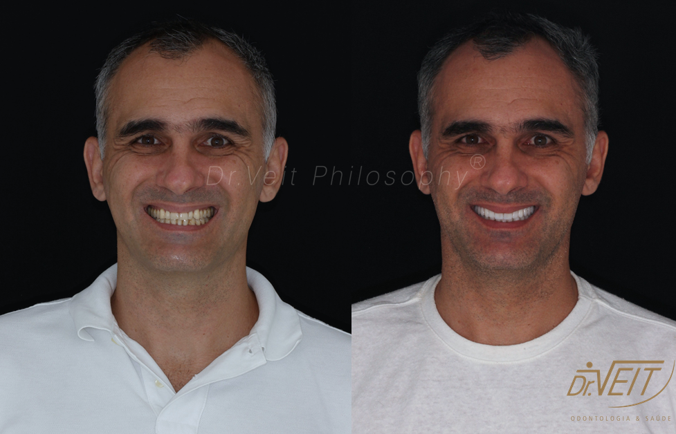 Antes e depois: caso real