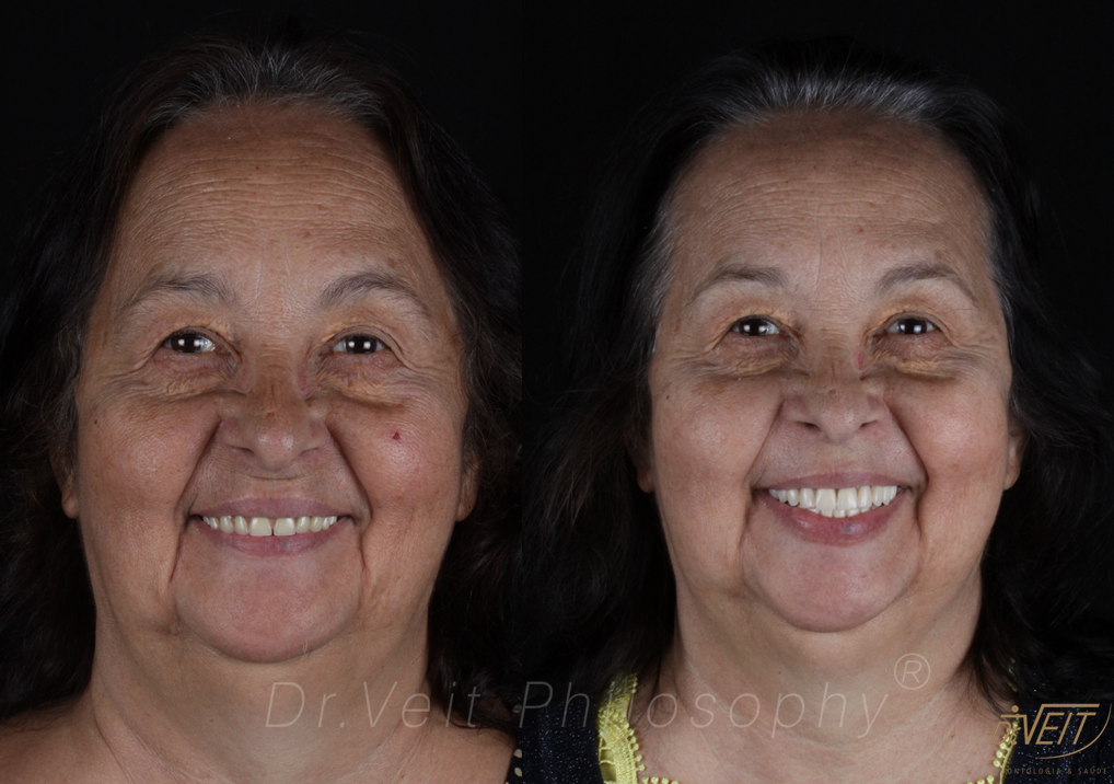 Antes e depois: caso real