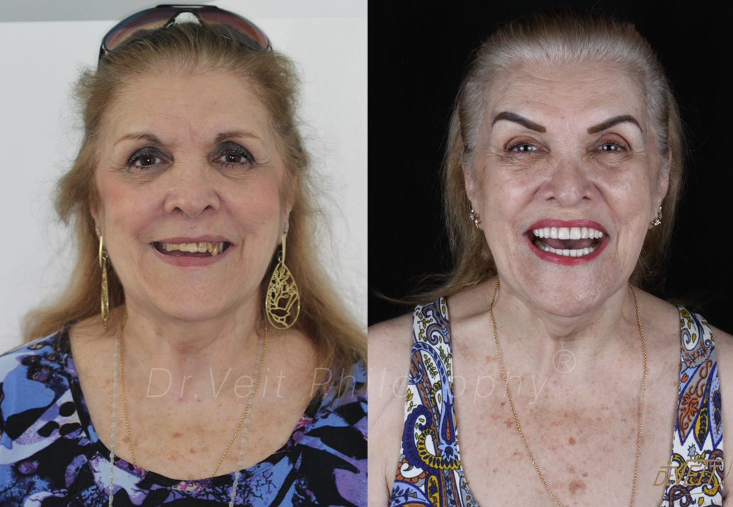 Antes e depois: caso real