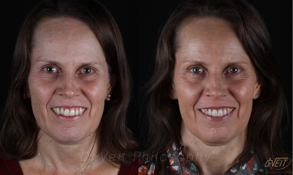 Antes e depois: caso real