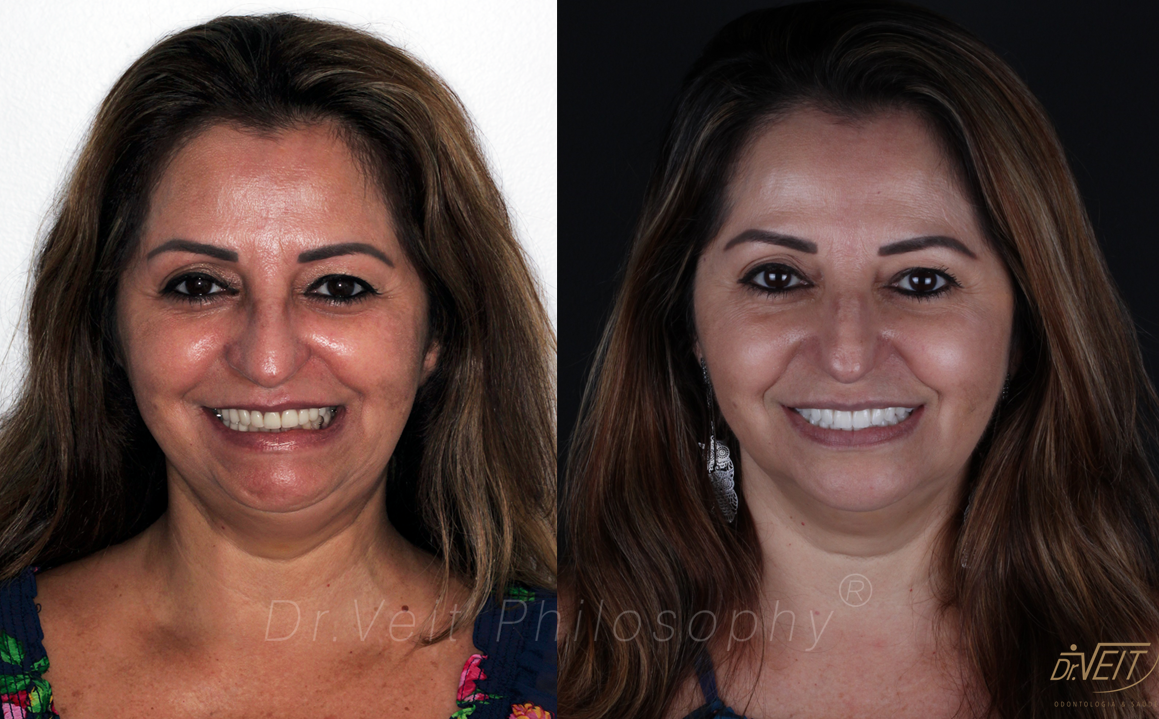 Antes e depois: caso real