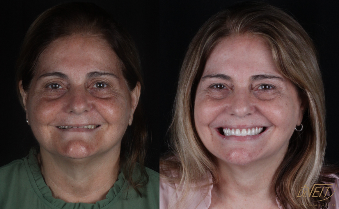 Antes e depois: caso real