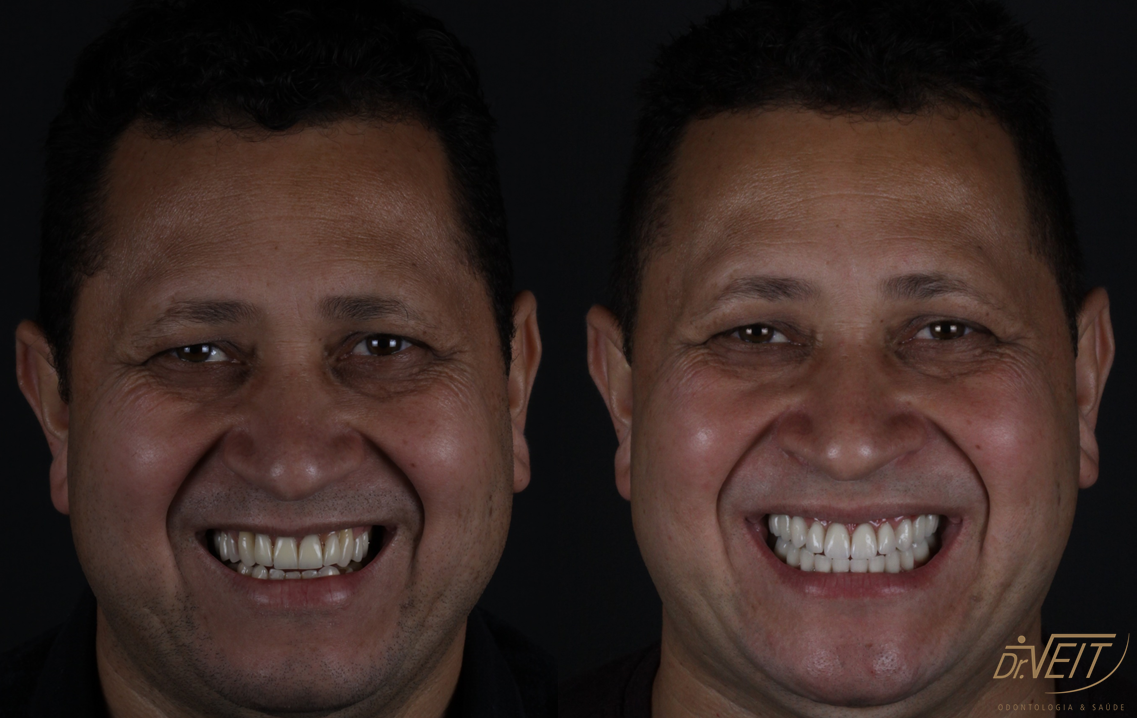Antes e depois: caso real