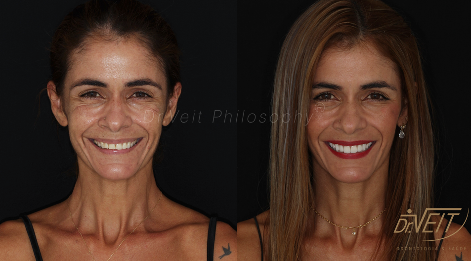 Antes e depois: caso real